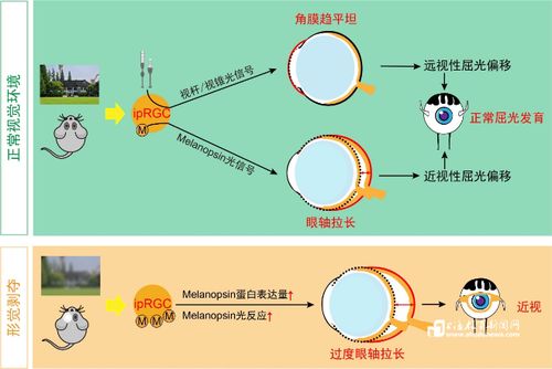 楊雄里院士團隊科研成果 細胞技術為近視干預策略研發(fā)開辟新思路